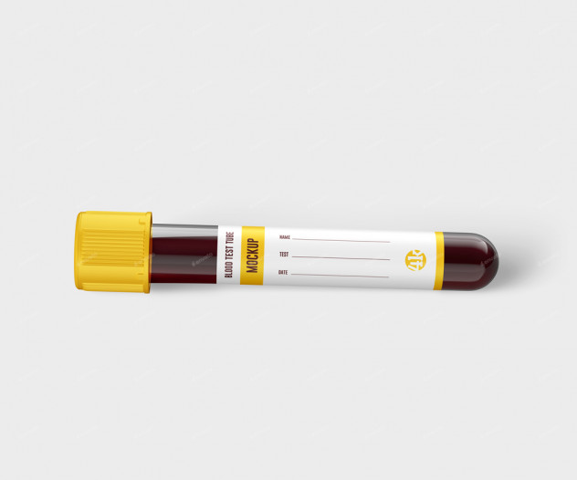 Blood Test Tube Mockup Set - product preview 1